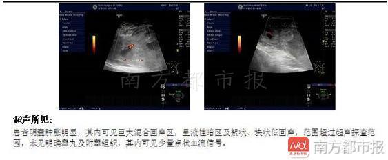 少年打麻藥自宮 陪他就醫(yī)的是幾個(gè)穿著女裝的“男”人