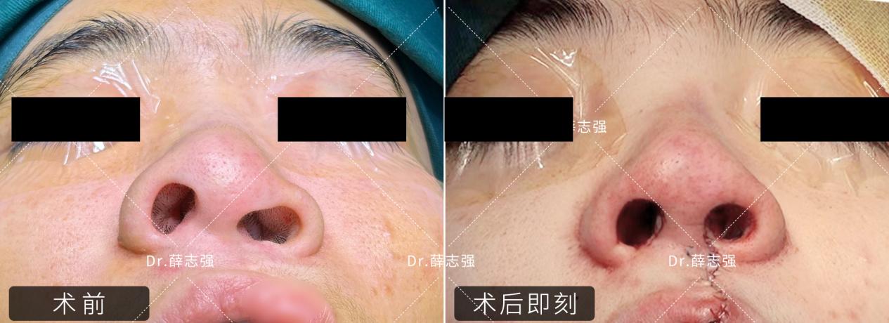 1699407828968077431.jpg 1699407828968077431.jpg